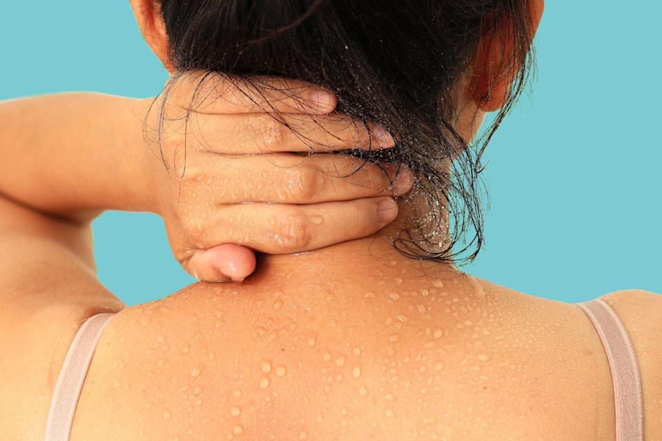  Sweating Is Healthy, but Are You Sweating Too Much?